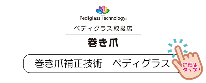 巻き爪補正技術　ペディグラス