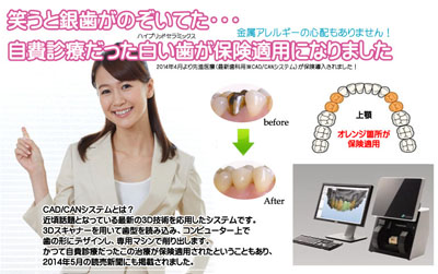 先進医療（最新歯科用※CAD/CANシステム）が保険導入されました