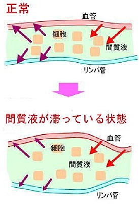 リンパドレナージとは？