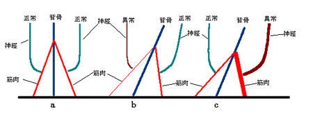 1本の支柱（背骨）を左右のロープ（筋肉）が支えている様子を現している図