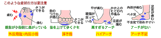 このような症状の方は要注意