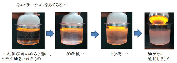 痩せる機械 キャビテーション