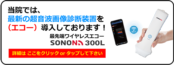 ワイヤレスエコーsonon300l